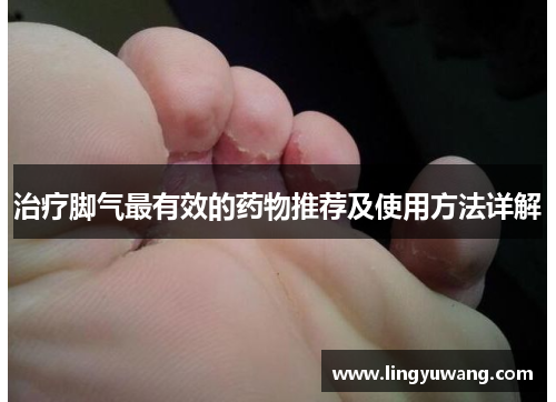 治疗脚气最有效的药物推荐及使用方法详解